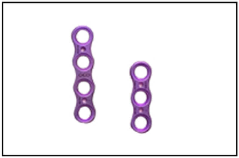 Extremity Plating System