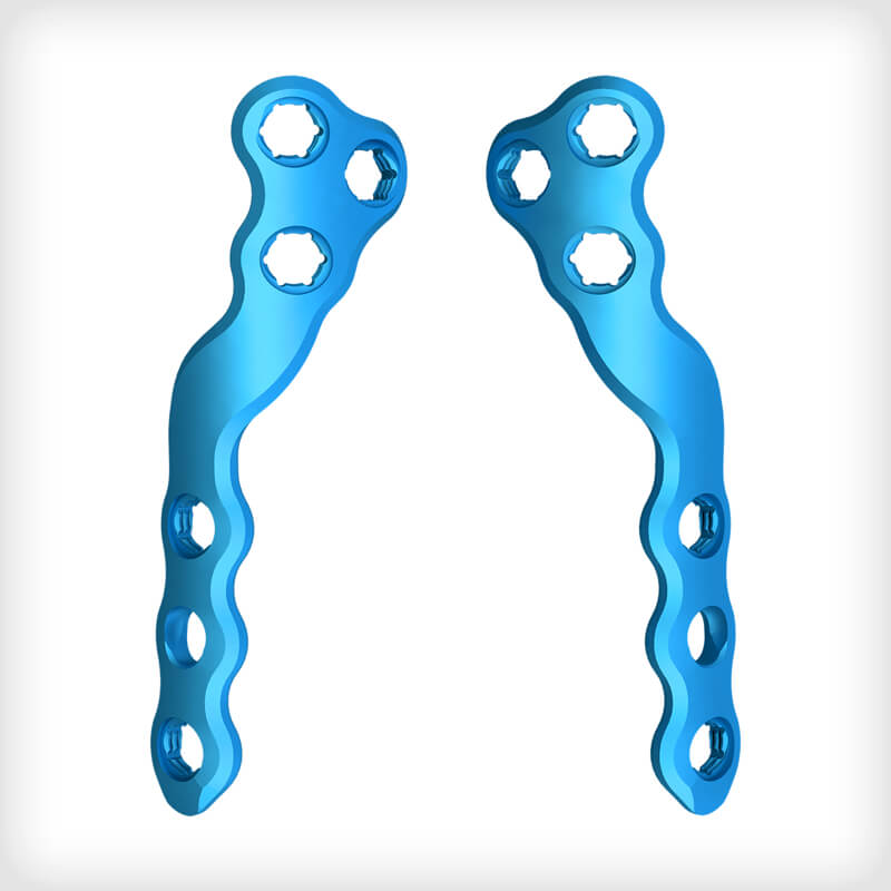 5th Metatarsal Spiral Fracture Plates
