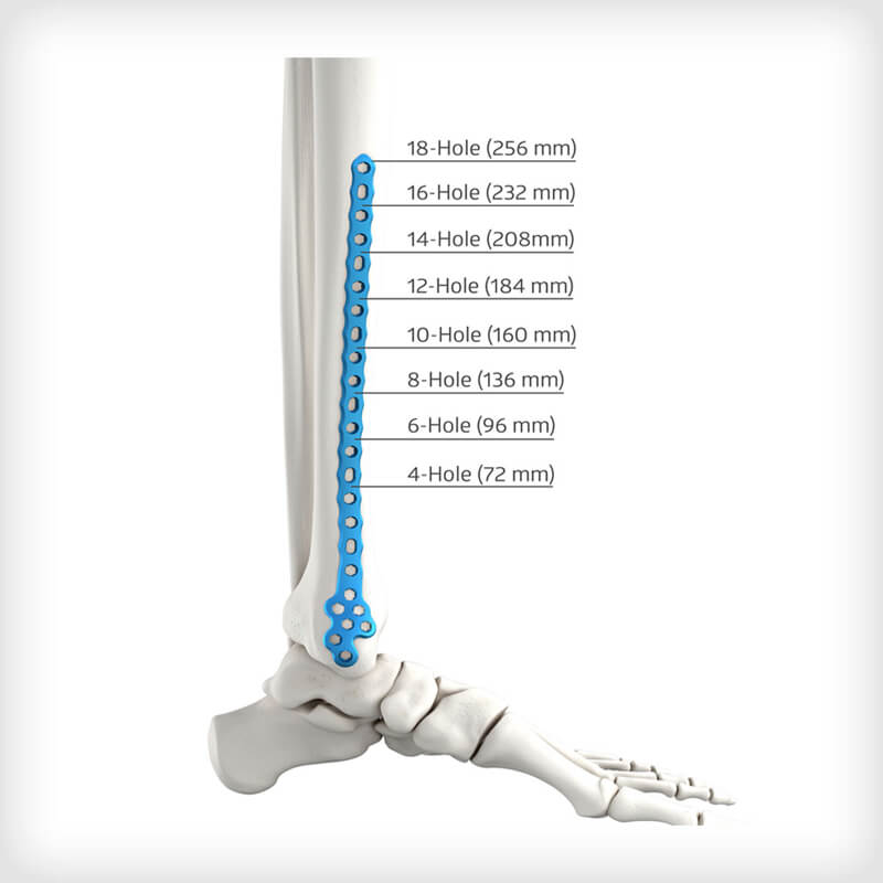 Medial Distal Tibia Plates