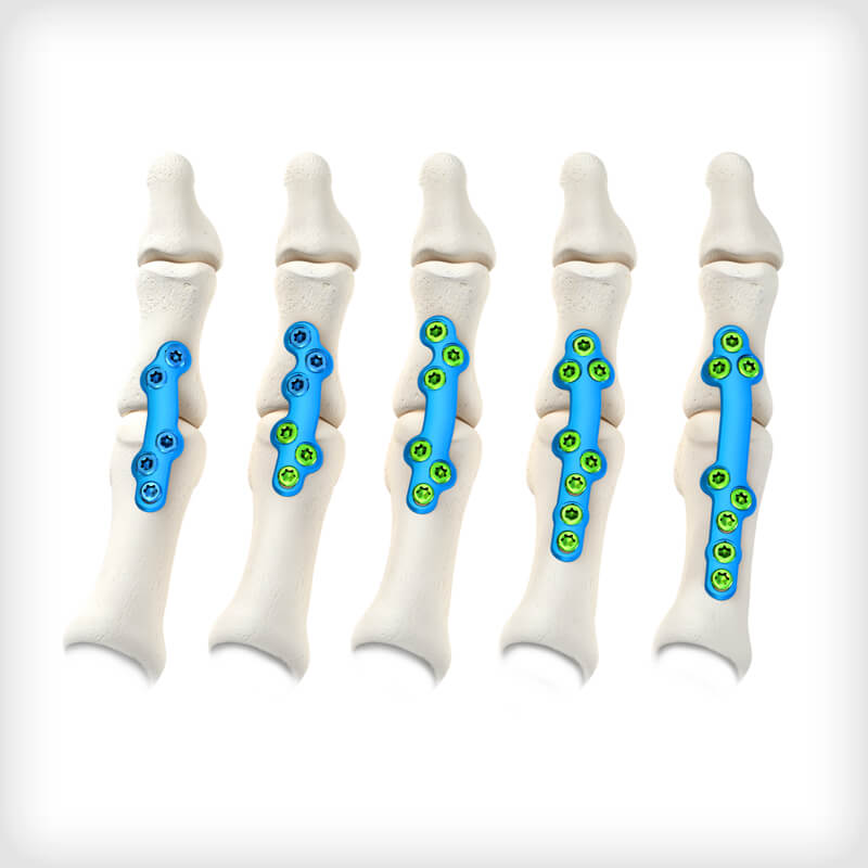 MTP Fusion Plates